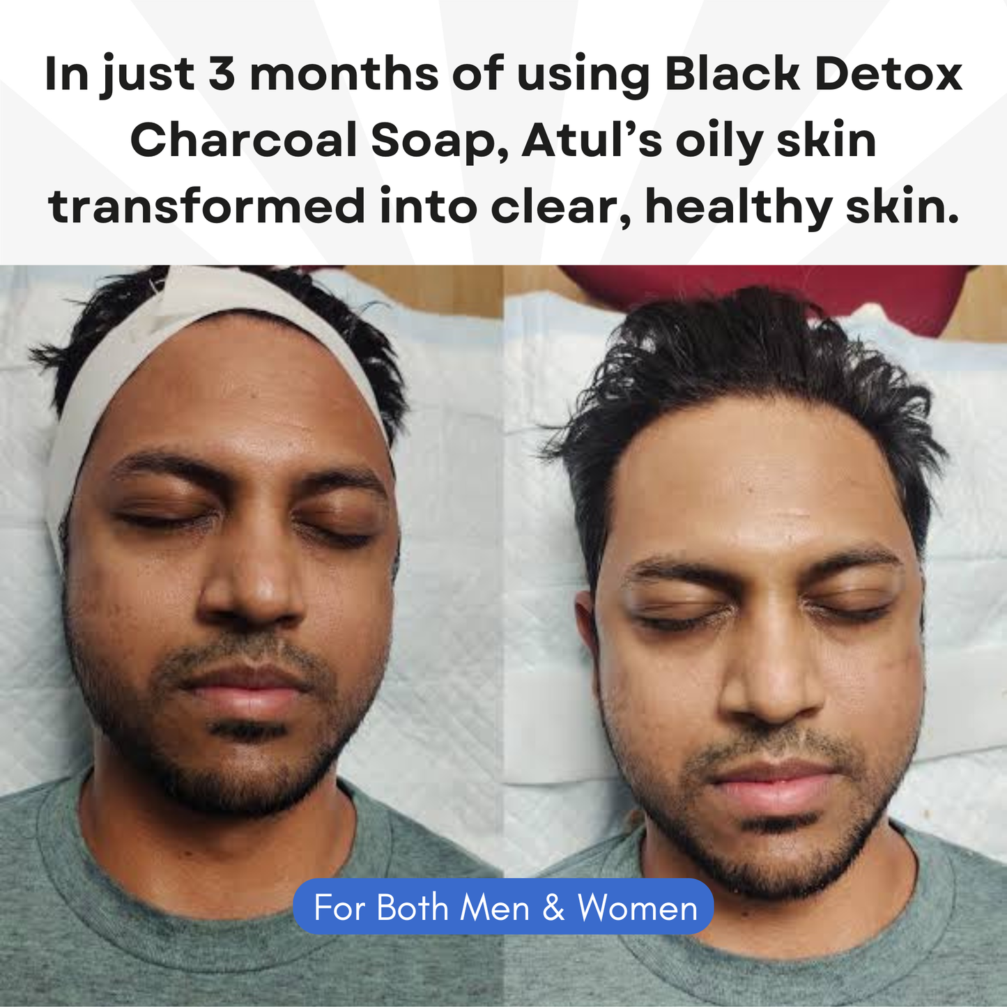 Ayurvedic Jeevanam Black Detox Charcoal Soap for Face & Body (Get 1 Free Red Wine Soap)