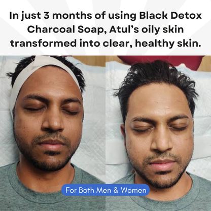 Ayurvedic Jeevanam Black Detox Charcoal Soap for Face & Body (Get 1 Free Red Wine Soap)