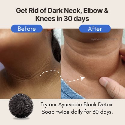 Combo of 3 Black Detox Charcoal Soaps & 1 Rose Body Wash To Remove Complete Body Tan