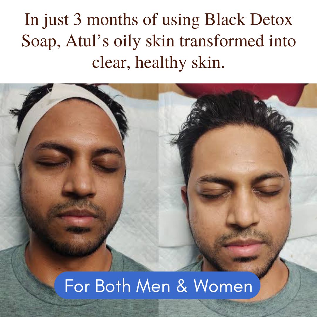 Ayurvedic Jeevanam Black Detox Charcoal Soap for Face & Body